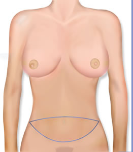 Abdominal Outline
