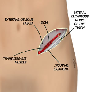 The Vessel Is Dissected Free