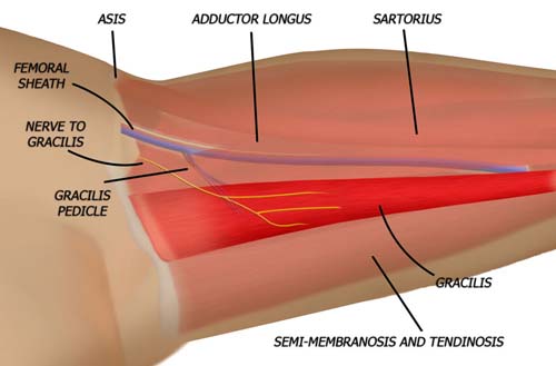 Vascular Anatomy of the Gracilis Muscle