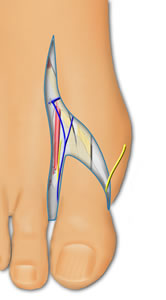 Nerves Are Ligated