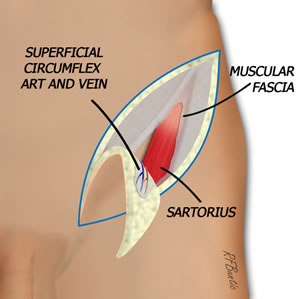 The Fascia Over Sartoriums is Elevated