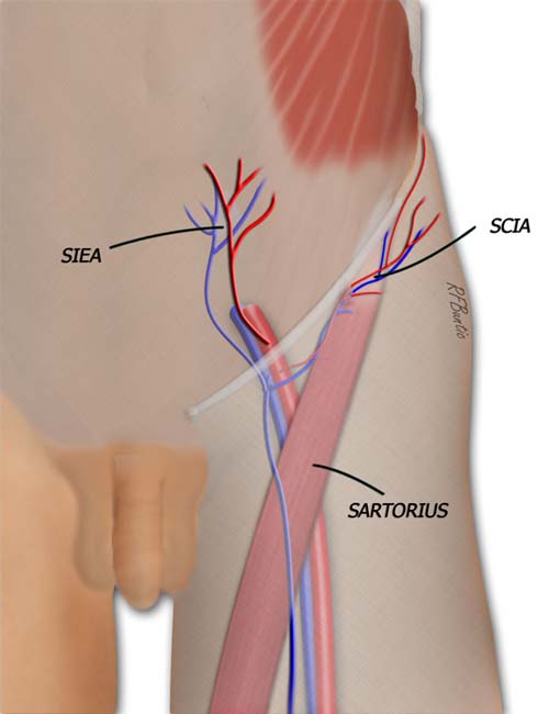 Groin Flap Vascular Anatomy