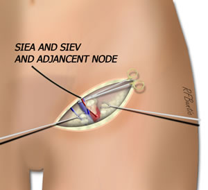 The Node and Vessels are Isolated