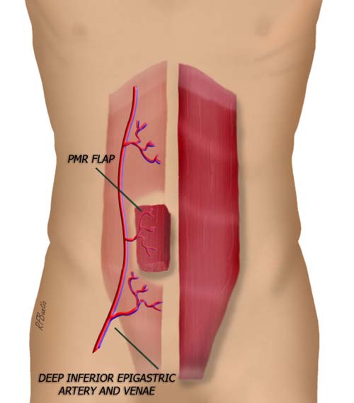 Anatomy of the PMR Flap