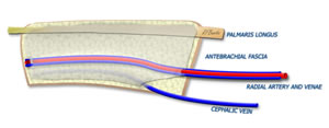 The Isolated Flap