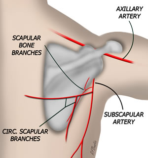 Scapula Bone Flap