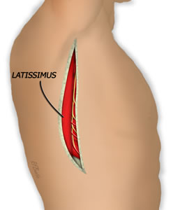 The Latissimus Border is Identified