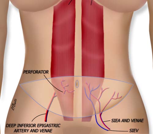 Anatomy of the SIEA Flap