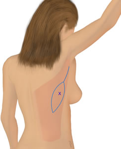 The Flap is Outlined