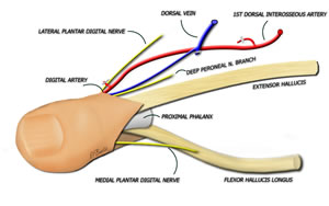 Isolated Toe Flap