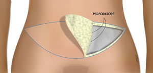 The Perforators are Identified