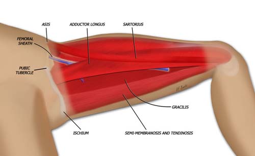 Anatomy of the Tug Flap